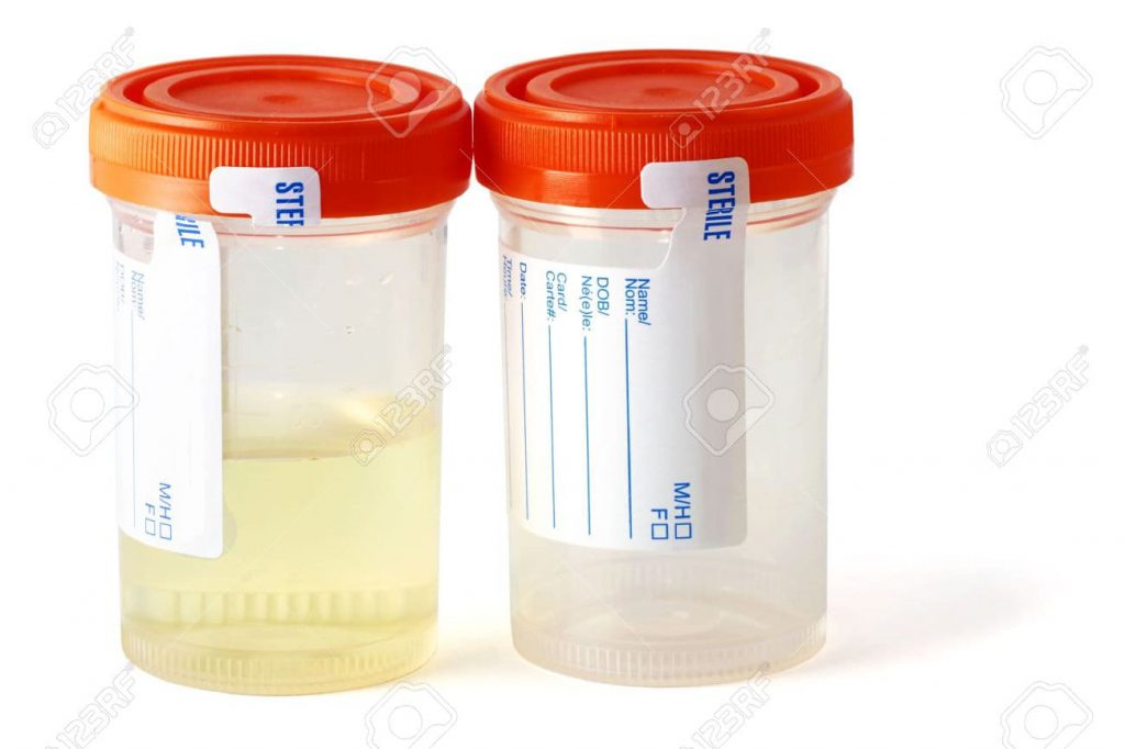 یورین باتل استریل | Urine Bottle